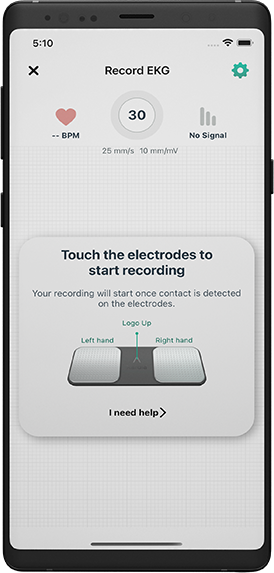 Advanced EKG Analysis Integration