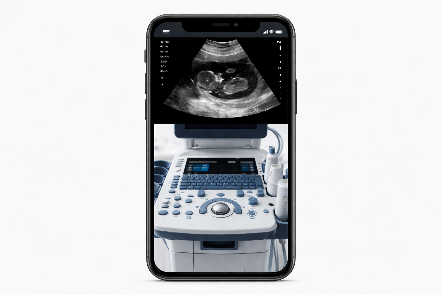 Digitizing Ultrasound Machine Demonstrations